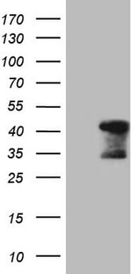TNNT2 / CTNT Antibody (clone OTI3C6)