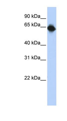Polyclonal Rabbit anti-Human STAU1 / Staufen Antibody (aa36-85, WB)