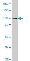 MUSK Antibody (clone 2H6)