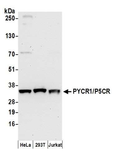 PYCR1 Antibody (aa269-319)