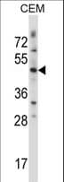 WNT3 Antibody (aa155-184)