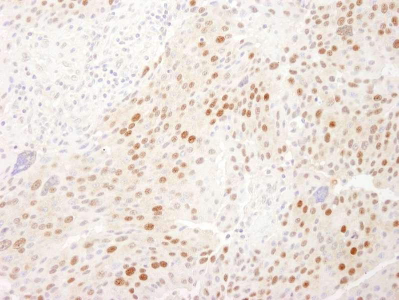 Polyclonal Rabbit anti-Human WDR77 / MEP50 Antibody (aa1-50, IHC)