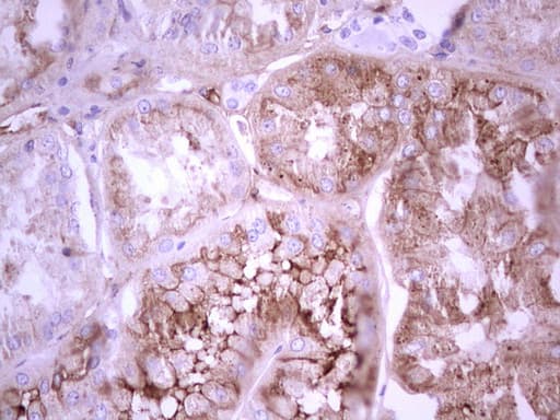 Monoclonal Mouse anti-Human CFI / Complement Factor I Antibody (clone OTI15E11, Carrier-free, aa340-583, IHC, WB)