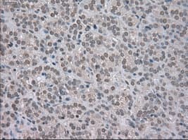 BUB1B / BubR1 Antibody (clone OTI5D9)
