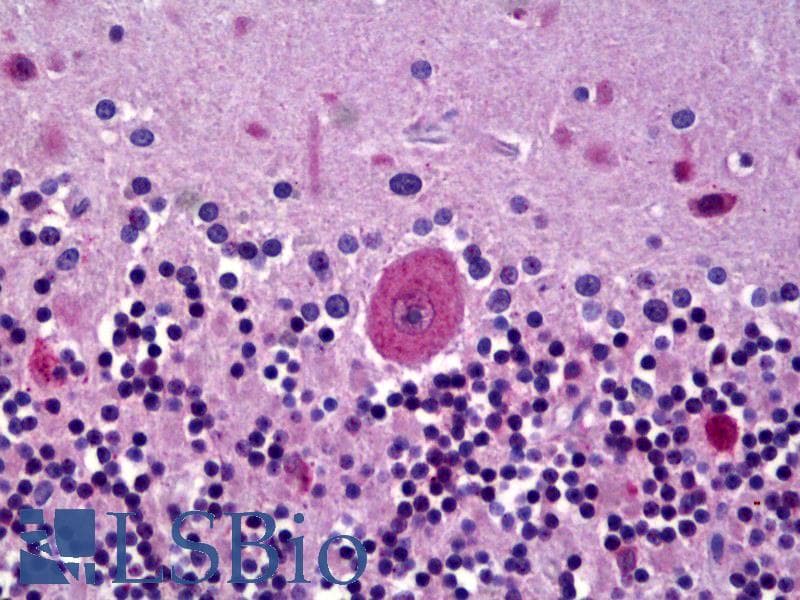 IHC-plus™ Polyclonal Rabbit anti-Human GLRA3 Antibody (C-Terminus, IHC, WB)