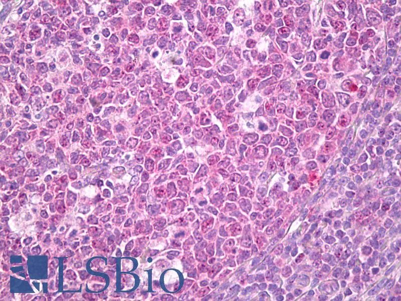 IHC-plus™ Monoclonal Mouse anti-Human ADRM1 Antibody (clone 3D11, IHC, WB)