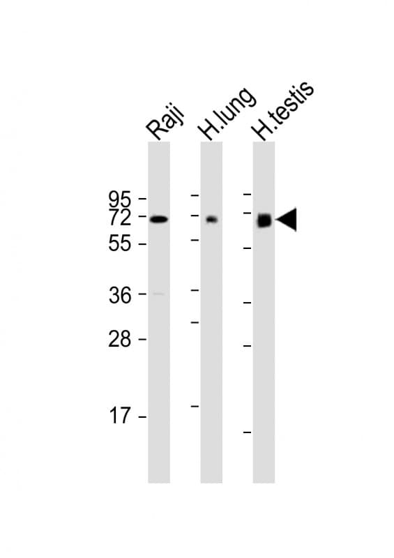 ERVK-7-Env Antibody (N-Terminus)
