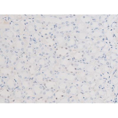 LIMK2 Antibody (phospho-Ser283)