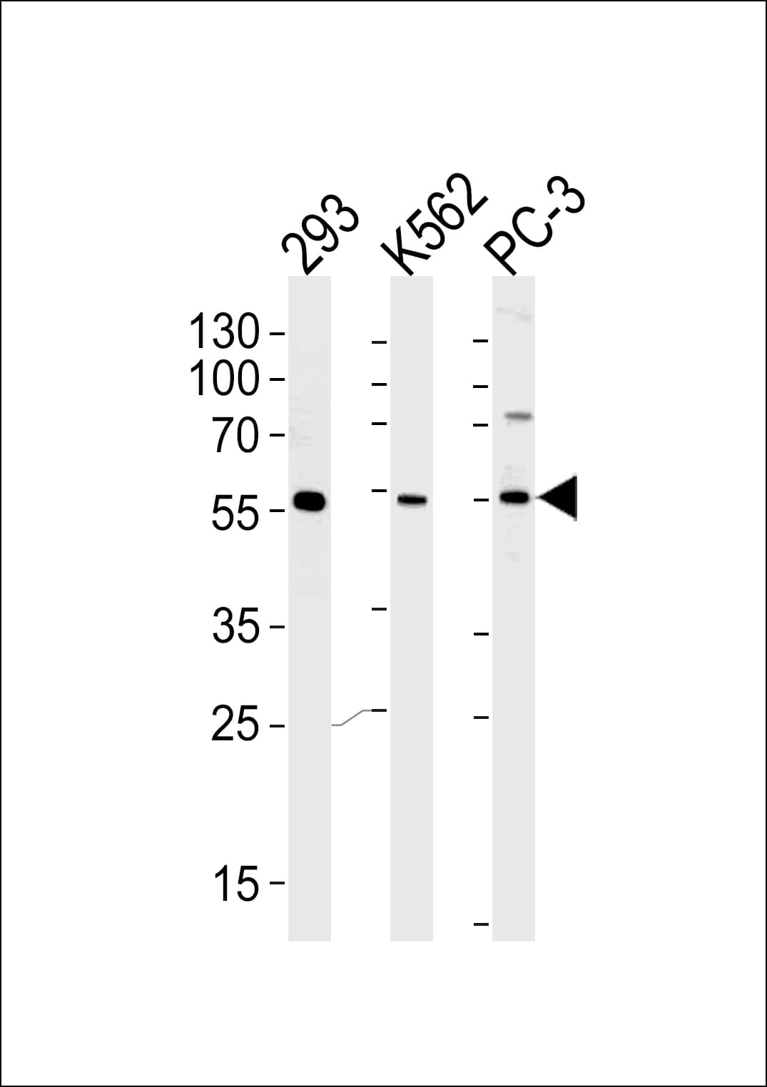PIP5KL1 Antibody (aa57-86)