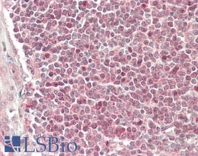 PathPlus™ BCL2L2 / Bcl-w Antibody (aa122-171)