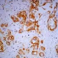 IHC-plus™ Monoclonal Mouse anti-Human CTNNB1 / Beta Catenin Antibody (IHC, WB)