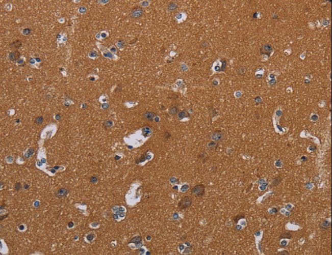 Polyclonal Rabbit anti-Human OMG / OMGP Antibody (IHC)