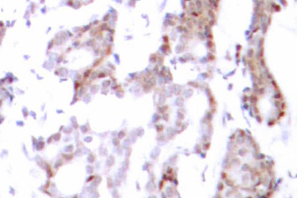 ELK1 Antibody (Ser383)