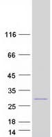Human RAB29 / RAB7L1 Protein (Recombinant Myc-DDK (Flag))