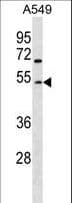 Polyclonal Rabbit anti-Human GCNT2 Antibody (aa213-240, WB)