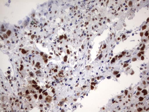 PARN Antibody (aa1-266, clone UMAB143, Carrier-free)