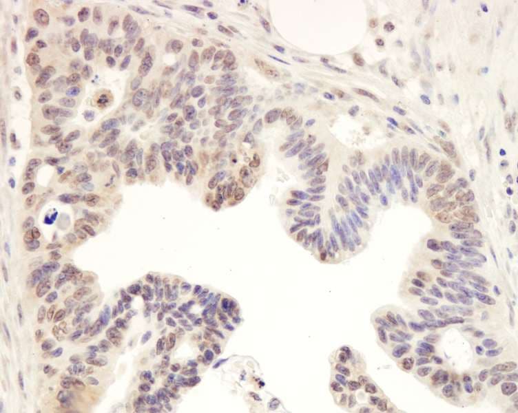 TIMELESS Antibody (aa1120-1170)