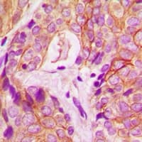 PRKCD / PKC-Delta Antibody (C-Terminus)