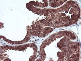 MEF2C Antibody (clone OTI1B6)