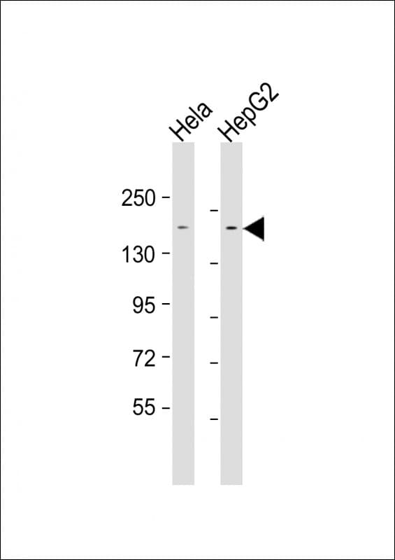 Monoclonal Mouse anti-Human ERBB2IP / Erbin Antibody (clone 1617CT859.9.32, WB)