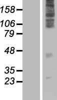 FAM57A / CT120 Protein (Over-Expression Lysate Myc-DDK (Flag))