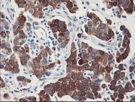 FDFT1 / Squalene Synthase Antibody (clone OTI1H9)