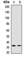 STX12 / Syntaxin 12 Antibody