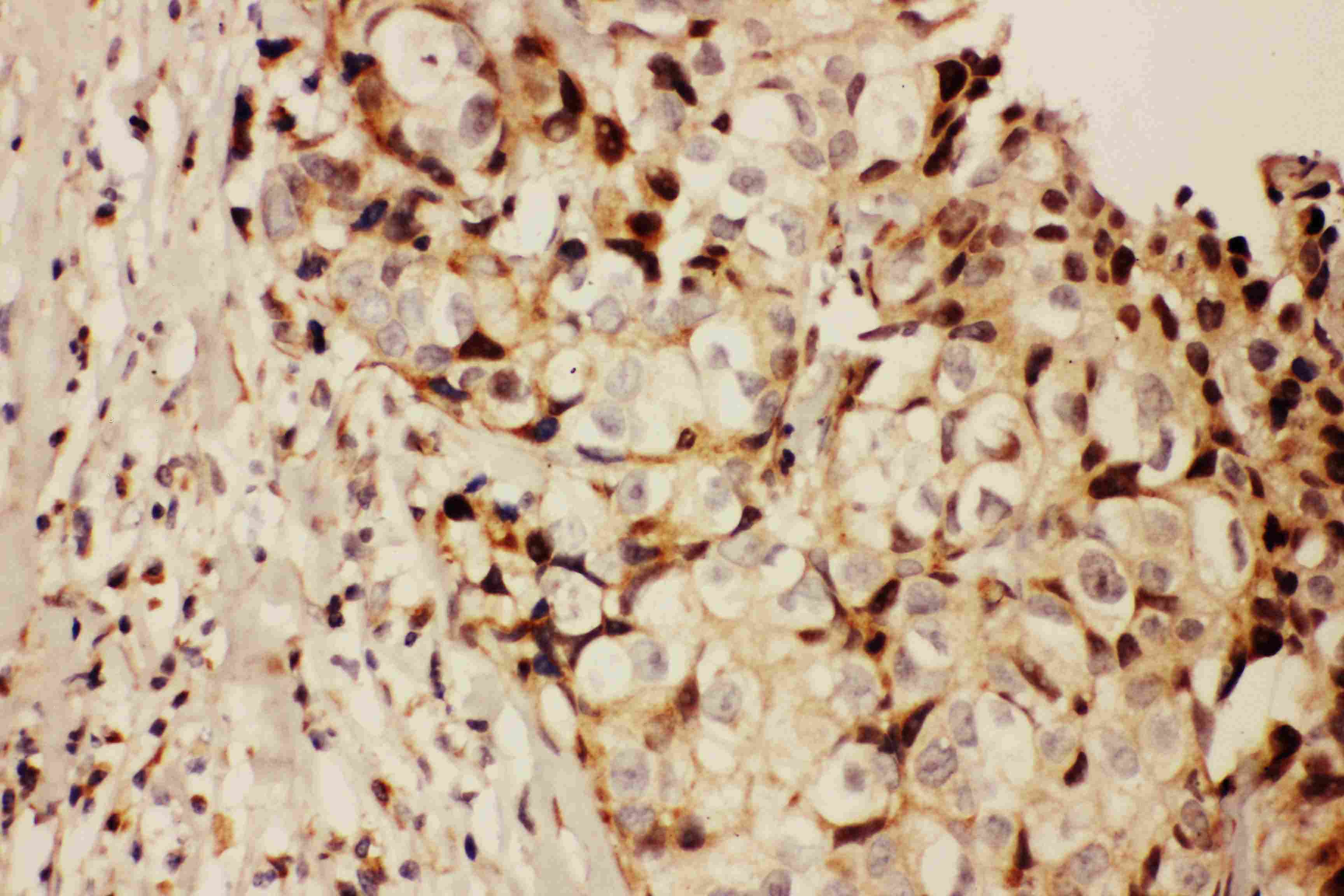 RFC1 / RFC Antibody (aa46-64)
