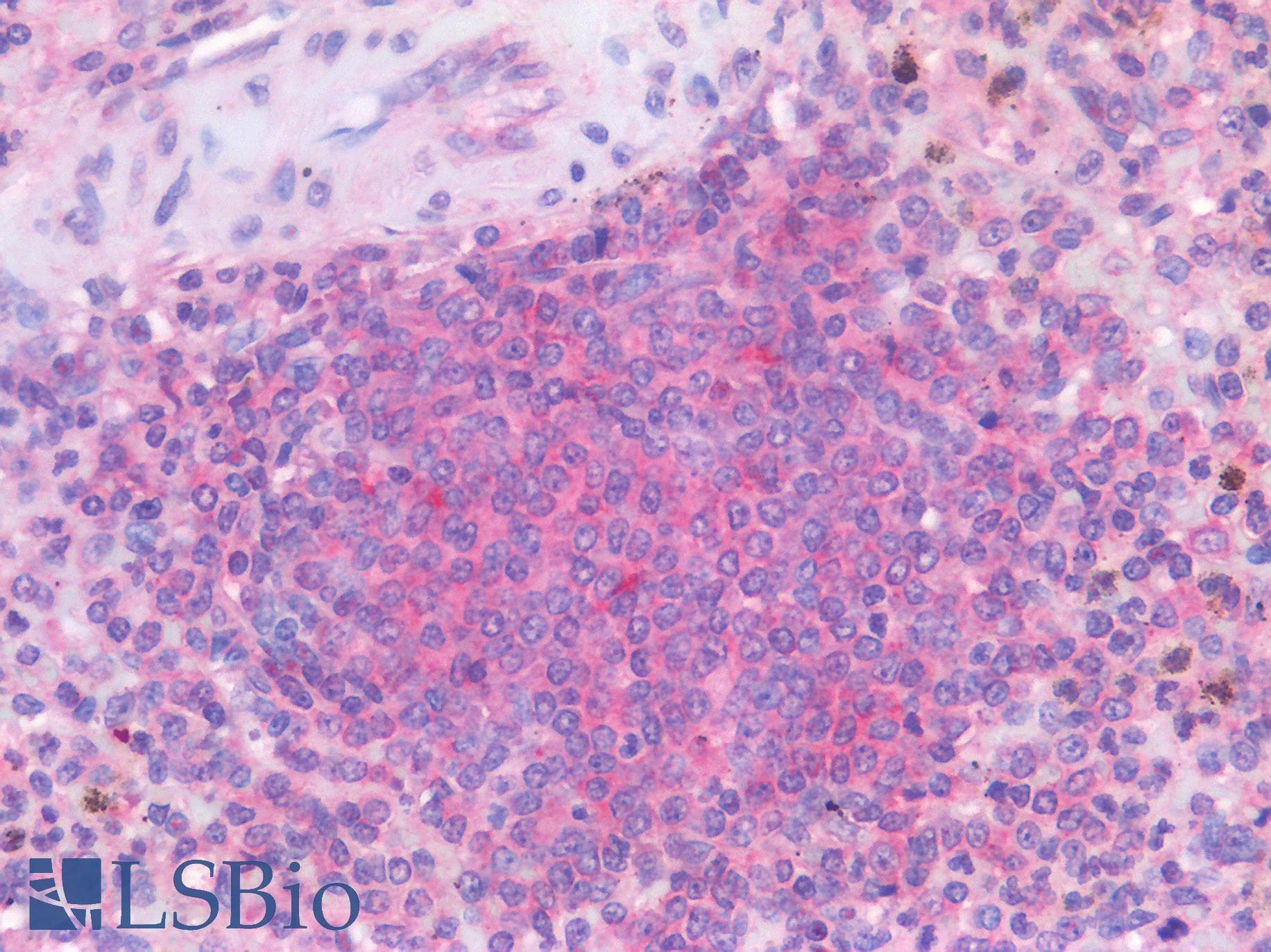 PathPlus™ Polyclonal Rabbit anti-Human DEC-205 / CD205 / LY75 Antibody (C-Terminus, IHC)
