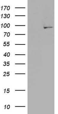PLA2G6 / IPLA2 Antibody (aa490-752, clone OTI10G4)