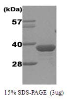 Human Geminin Protein (Recombinant His)