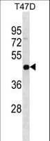 Polyclonal Rabbit anti-Human IL-22BP / IL22RA2 Antibody (aa15-42, WB)