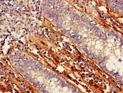 PTCH1 / Patched 1 Antibody