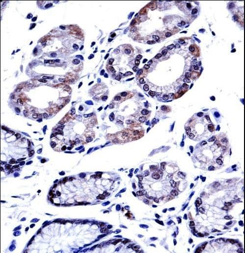 G3BP1 / G3BP Antibody (aa401-430)