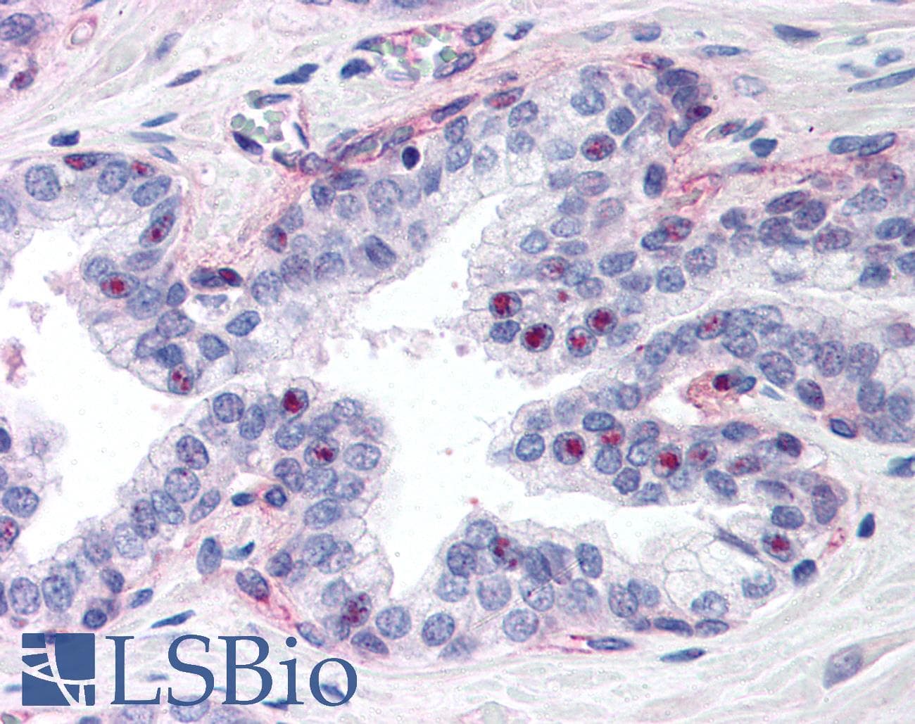 IHC-plus™ PPARG / PPAR Gamma Antibody