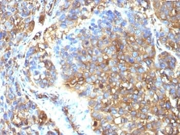 MSN / Moesin Antibody (clone MSN/493)