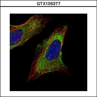 TOM1L1 Antibody (aa413-476)