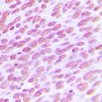 CDC25C Antibody (Internal)