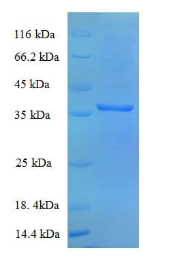 E. coli mdh / Malate Dehydrogenase Protein (Recombinant His)