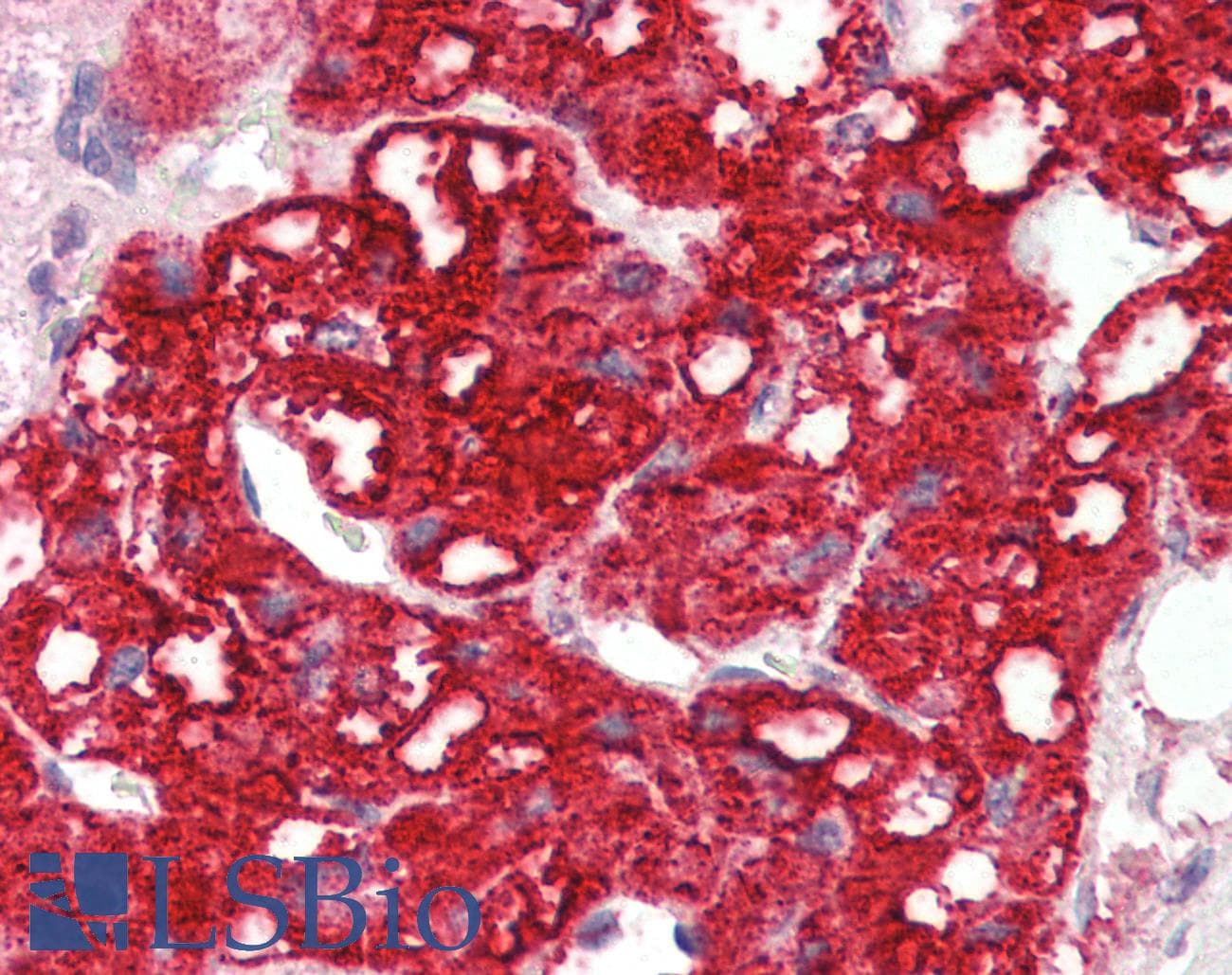 IHC-plus™ STYK1 Antibody (clone 2H2F10)