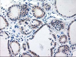 TBC1D21 Antibody (clone OTI2A6, Carrier-free)