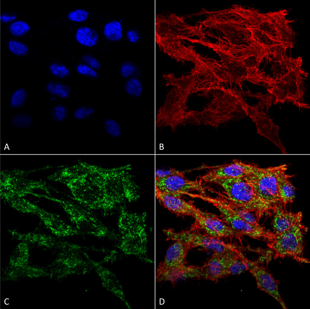 TMEM49 Antibody