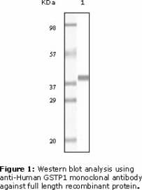 GSTP1 / GST Pi Antibody (clone 3F2C2)