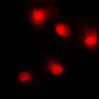 Polyclonal Rabbit anti-Human TP53 / p53 Antibody (N-Terminus, IHC, IF, WB)
