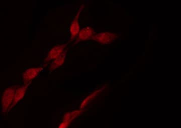 Polyclonal Rabbit anti-Human POLB / DNA Polymerase Beta Antibody (IHC, IF, WB)