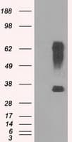 RNF144B Antibody (clone OTI11F4)