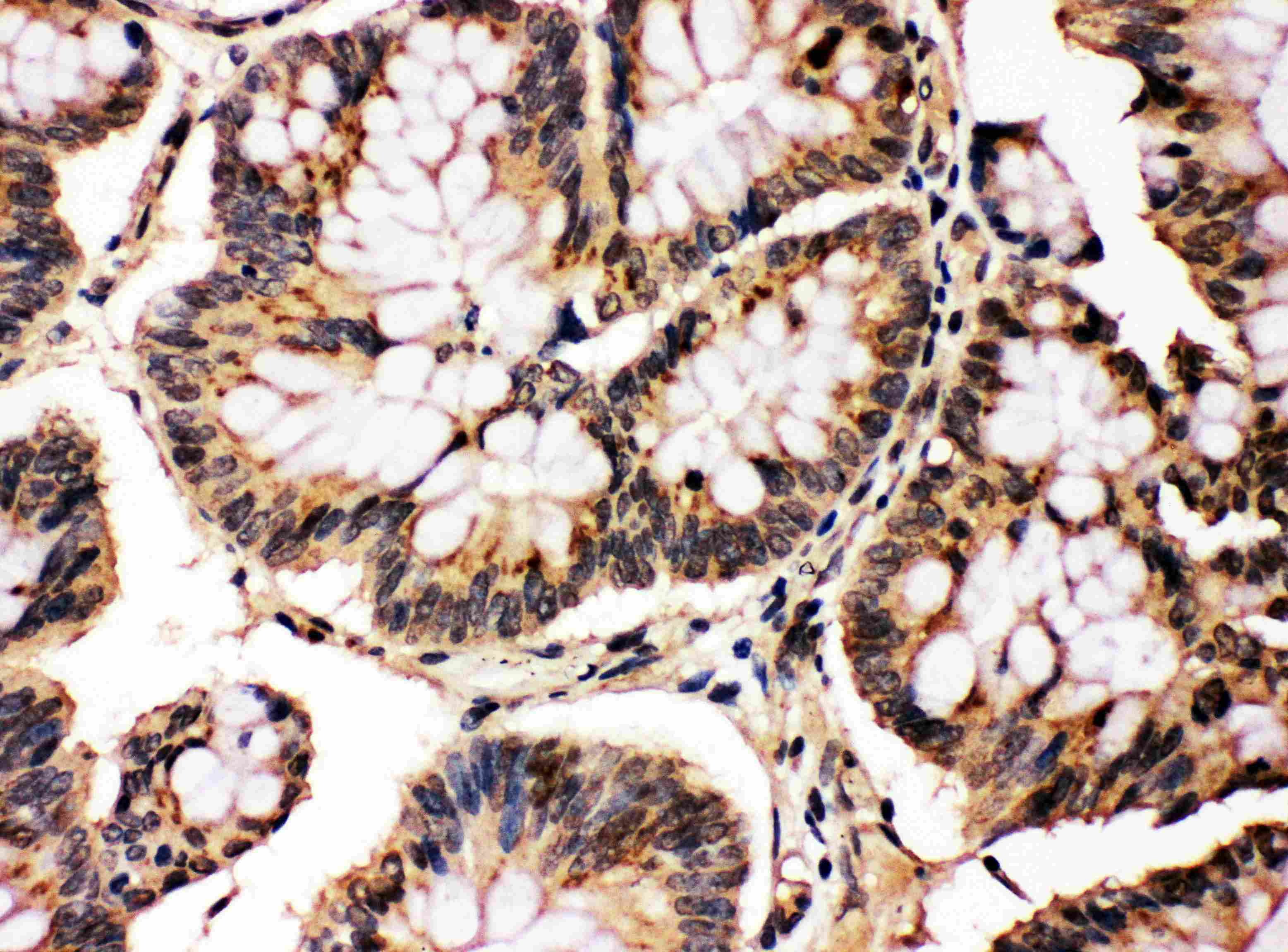Polyclonal Rabbit anti-Human MAPK8 / JNK1 Antibody (aa344-363, IHC, WB)