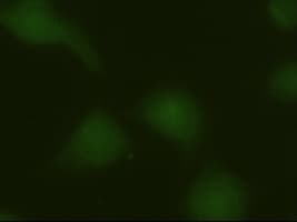 Monoclonal Mouse anti-Human MAPK6 / ERK3 Antibody (clone OTI5E1, IF, WB)