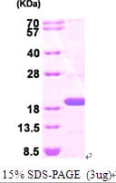 Human TSG101 Protein (Recombinant His)