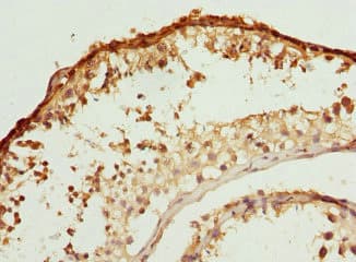 BBS2 / BBS Antibody